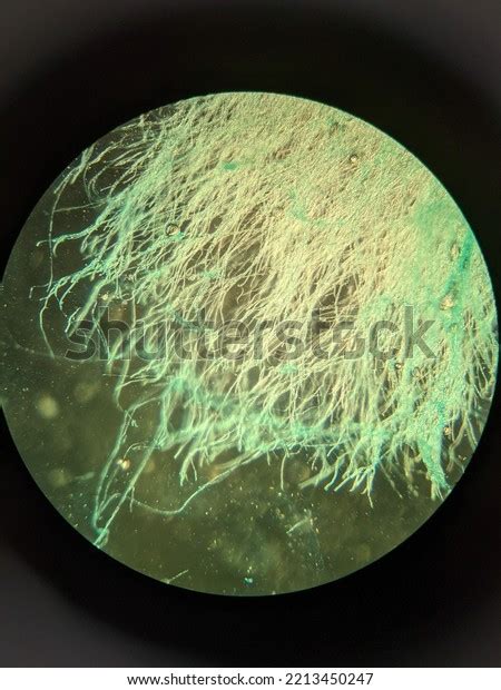 Photo Fungi Mold Mycelium Growth Spores Stock Photo 2213450247 ...