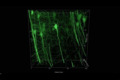 Laser microscopes let us peer into the brain, and it's truly beautiful ...