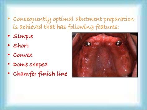 Overdenture