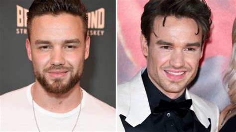 Liam Payne's Stunning Transformation: Facial Features Before and After ...