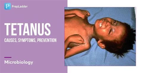 Tetanus: Causes, Symptoms, Prevention