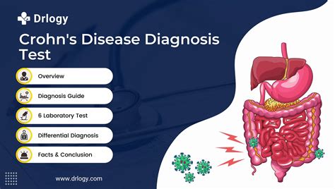 6 Easy and Effective Tests for Crohn's Disease Diagnosis - Drlogy