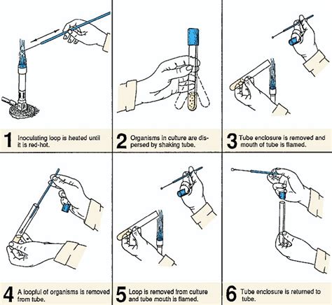 Avibert: Procedure for removing organisms from a broth culture with ...