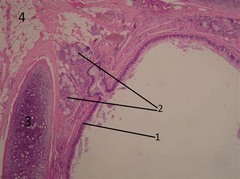 Bronchus (histology) - WikiLectures