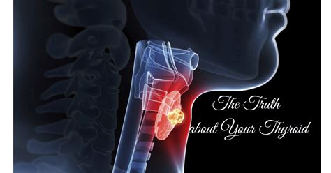 The Truth about Your Thyroid: Thyroid Dysfunction Causes & Natural ...