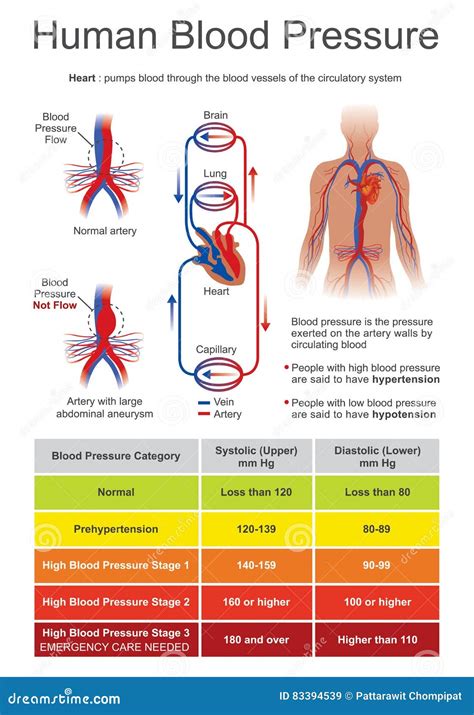 Hypotension Low Blood Pressure Cartoon Illustration Royalty-Free Stock ...