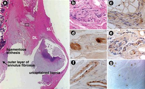 Annulus Fibrosus Histology