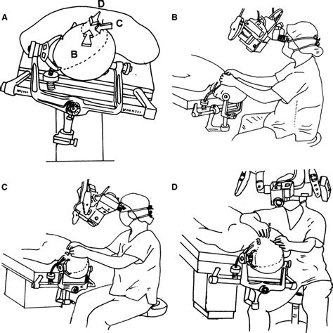 Schematic presentation of the prone oblique position (A) and the... | Download Scientific Diagram