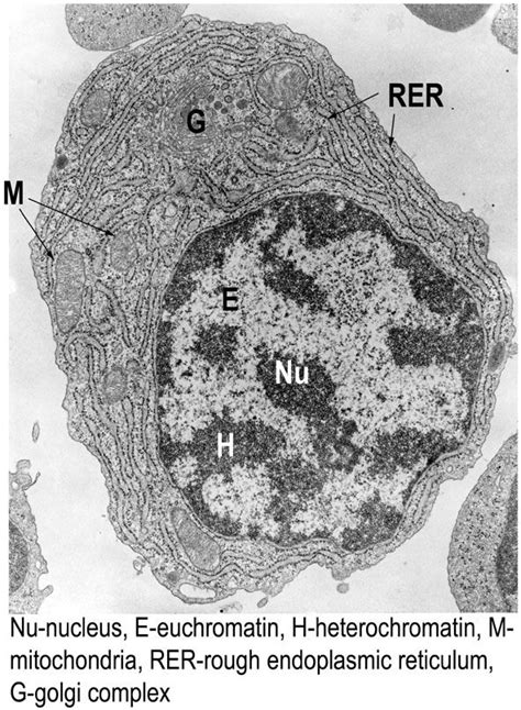 Euchromatin: majority chromatin; is in extended (decondensed state during interphase); only ...