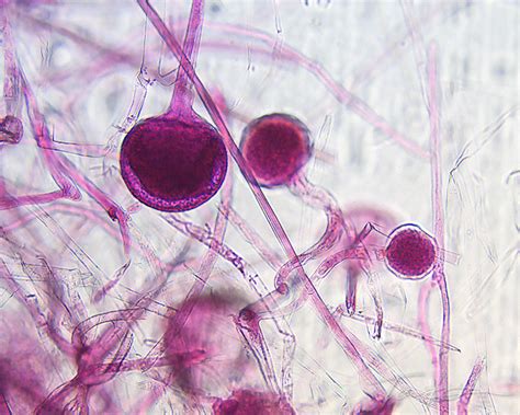 Rhizopus Sporangia (100x) | This is a micrograph of a Rhizop… | Flickr