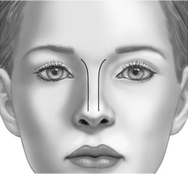 Treatment Planning: Facial Aesthetics | Plastic Surgery Key