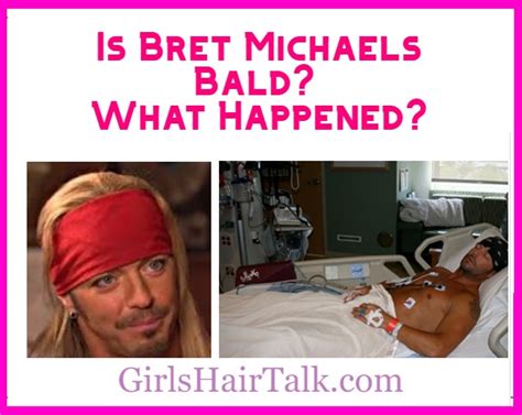 Is Bret Michaels Bald? Does He Wear A Wig? What Happened?