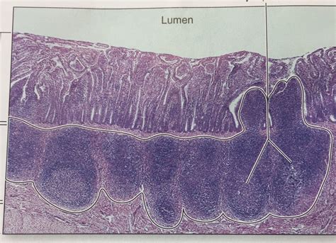 Ileum Diagram | Quizlet