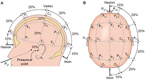 Fig. 13.2A.