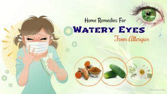 20 Home Remedies For Watery Eyes From Allergies