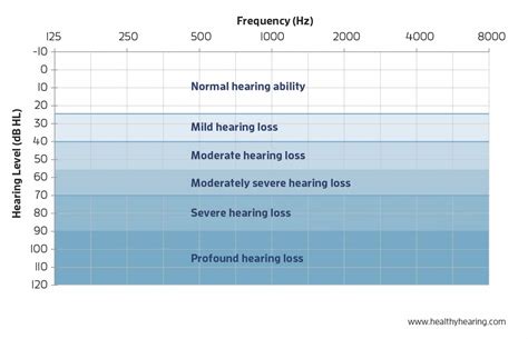 Degrees of Hearing Loss - Understanding Your Hearing Test Results