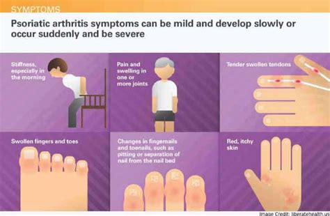 Psoriatic Arthritis - Symptoms, Causes, Treatment & More