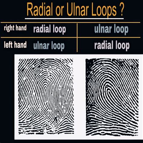 Fingerprint (ulnar loop or radial loop) | Left handed, Analysis, Loop