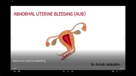 Pathophysiology Of Abnormal Uterine Bleeding