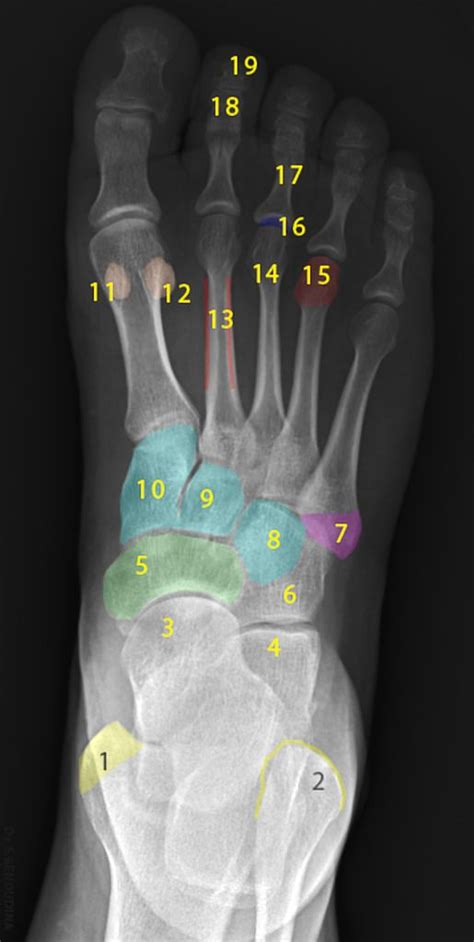 Normal radiographic anatomy of the foot | Radiology Case | Radiopaedia.org | Radiology ...