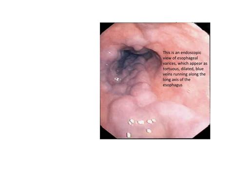 PPT - Gastrointestinal Pathology PowerPoint Presentation, free download ...