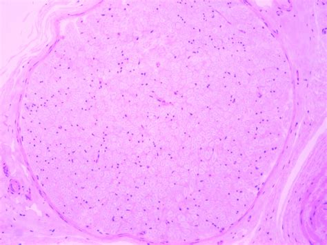 Peripheral Nerve Bundle