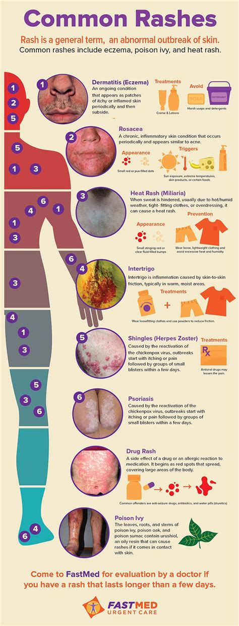 Identifying Common Rashes | Infographic