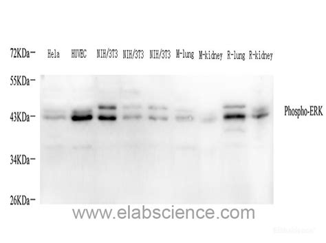 High Affinity and Specificity Phospho-ERK 1/2 (Thr202/Tyr204) Polyclonal Antibody E-AB-70310 at ...