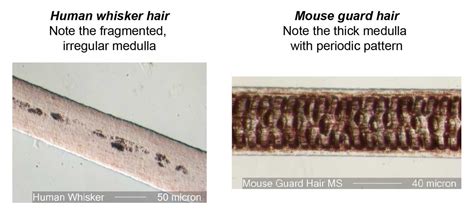 Hair Under a Microscope - Rs' Science