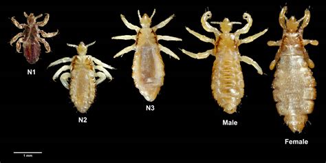 Body Lice - What Does Body Lice Look Like? - Symptoms & Treatment