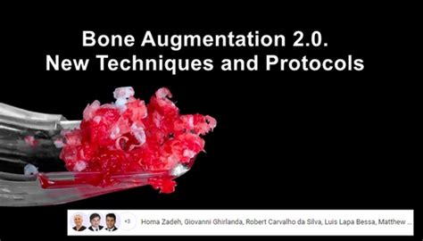 Bone Augmentation 2.0. New Techniques and Protocols - Dentistry eBooks