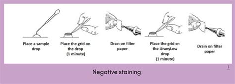 Sample preparation for Electron microscopy - My Biology Dictionary