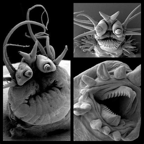 Tapeworm Under A Microscope