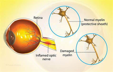 Health Condition : Symptoms, Causes, Treatment and More