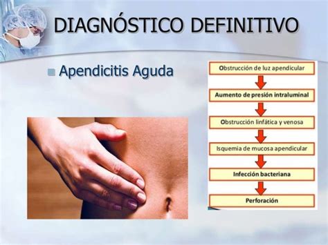 Historia clínica apendicitis