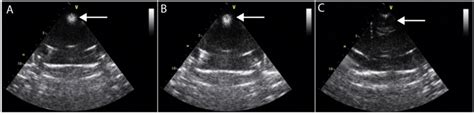 B-mode ultrasound images of freshly prepared plain (A) and... | Download Scientific Diagram