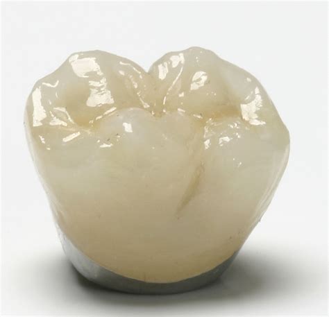 News Room - ROE Dental Laboratory: Fixed-Fee Pricing on Crowns