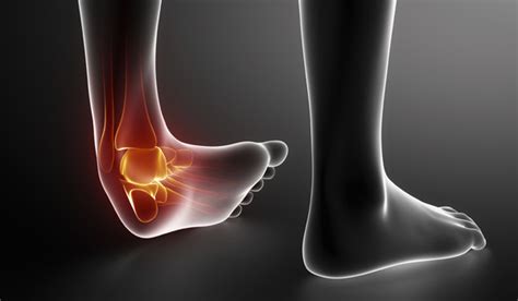 Factors Involved in Recovery Times For Soft Tissue Injuries