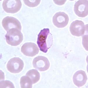 CDC - DPDx - Malaria