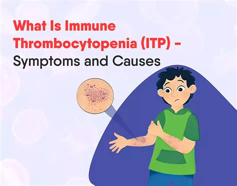 What Is Immune Thrombocytopenia (ITP) - Symptoms and Causes