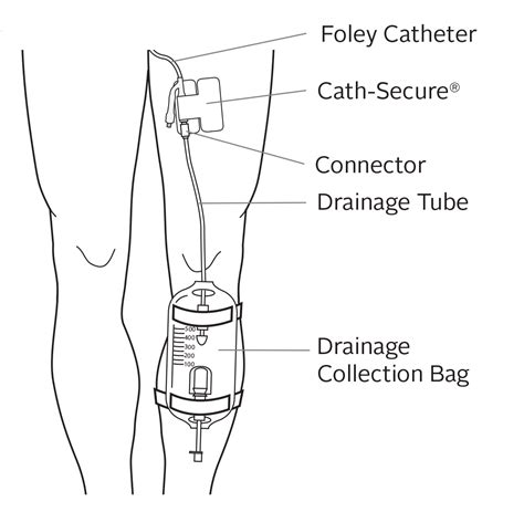 Caring for your urinary foley catheter – Artofit