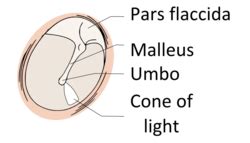 Pars flaccida of tympanic membrane - Wikipedia