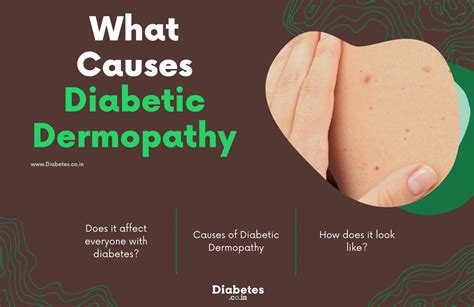 What is Diabetes Dermopathy?