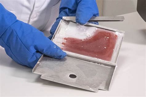 The Importance of Cryopreservation in Regenerative Medicine - OriGen ...