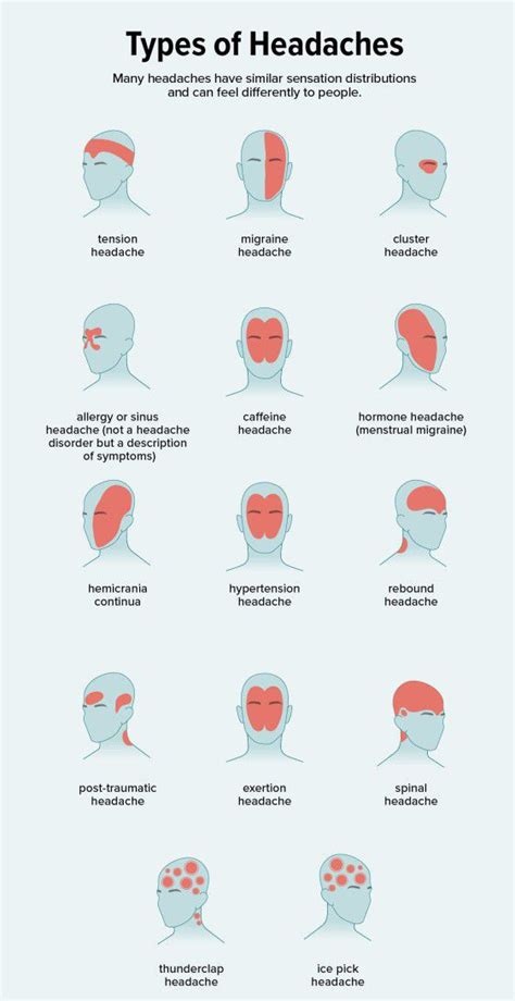 Types of Headaches - MEDizzy