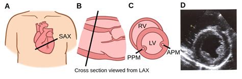 Parasternal short axis view in the papillary plane - Labster