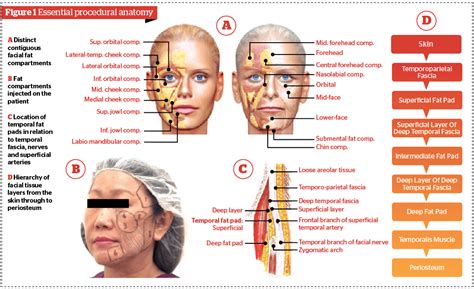 Targeted FAT (Facial-Aponeurosis-Tensing) lift | PRIME Journal