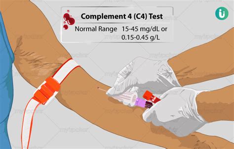 Complement 4 (C4) Test: Procedure, Purpose, Results, Normal range, Cost ...