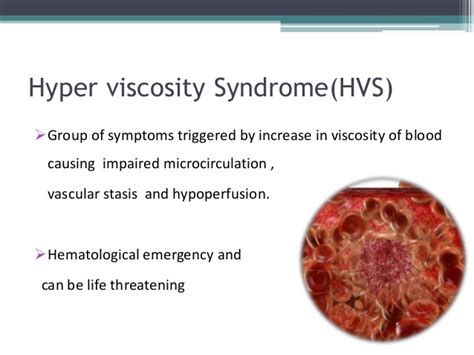 Emory doctors find link between hyperviscosity, clotting and ...