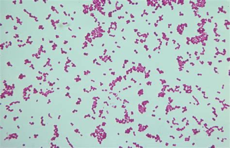 Neisseria Gonorrhoeae Gram Stain